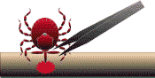 Proper tick removal. From CDC website.